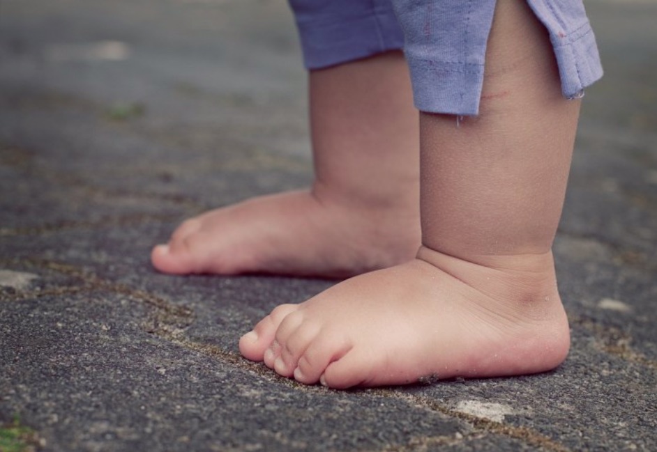 Okiem fizjoterapeutki: CHODZIKI powyżej 8 miesiąca życia dziecka jako zaburzenie naturalnego chodu